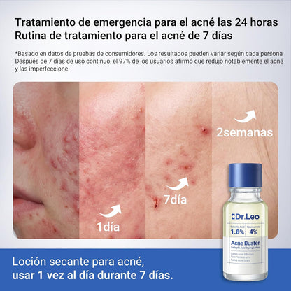 Serum Dr. Leo tratamiento Acné