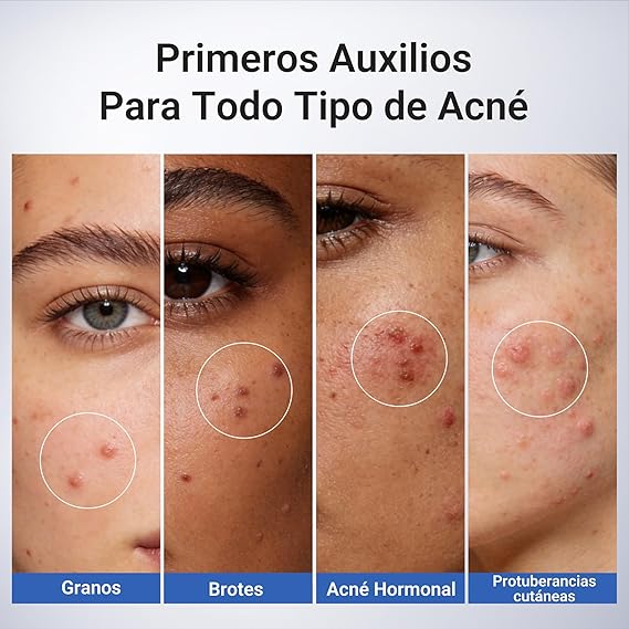 Serum Dr. Leo tratamiento Acné